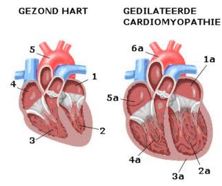 niet gedilateerde lv|Linkerventrikelhypertrofie: oorzaken, symptomen, behandeling.